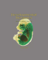 schroeter-DEV